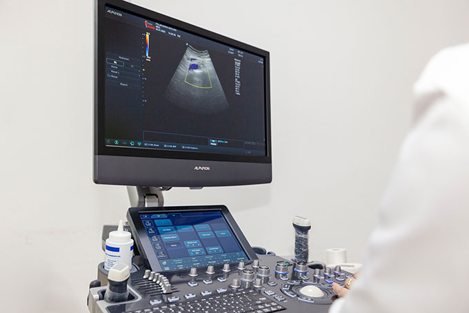 ULTRAZVUČNI PREGLED SRCA